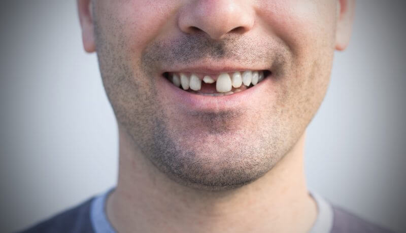 Help you in a dental emergency