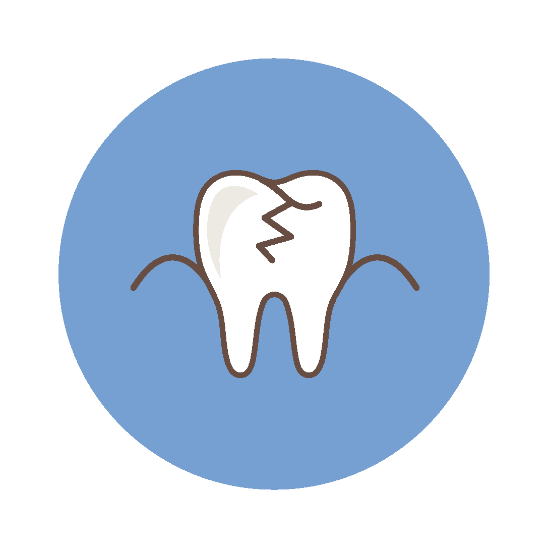 Broken tooth as a result of trauma